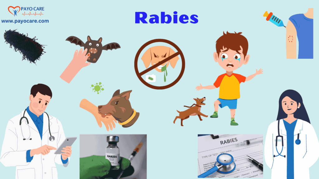 Rabies :Types, Causes, Symptoms, Prevention, Diagnosis & Treatment Rabies :Types, Causes, Symptoms, Prevention, Diagnosis & Treatment